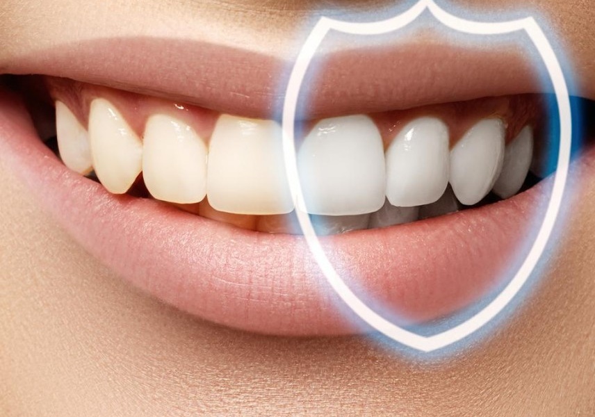 Как ухаживать за зубами, чтобы реже видеть стоматолога